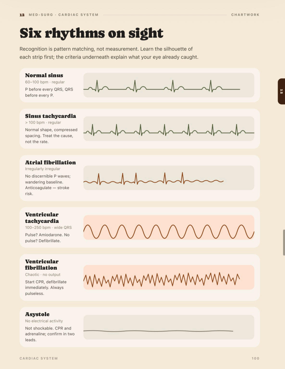 Sample page: six cardiac rhythms on sight, from normal sinus to asystole